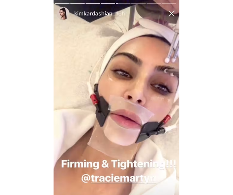 Kim-kardashian-face-treatment