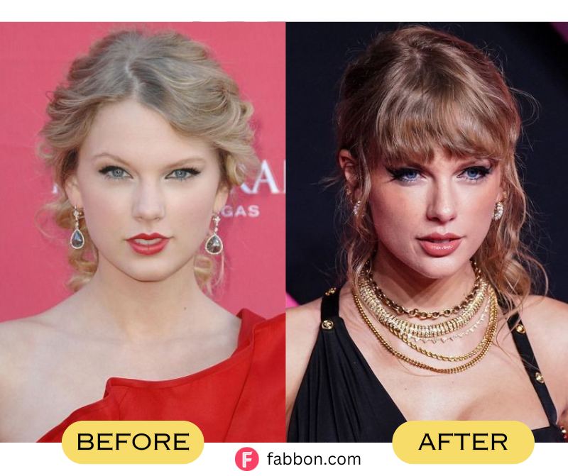 Taylor-Swift-Plastic-Surgery