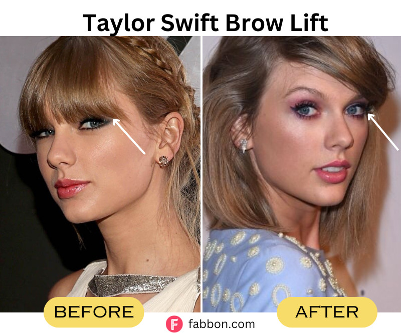Taylor-Swift-Brow-Lift