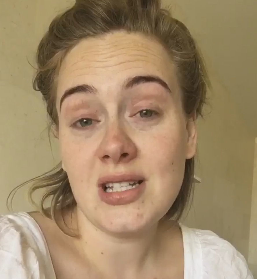 Adele-no-makeup-natural-face