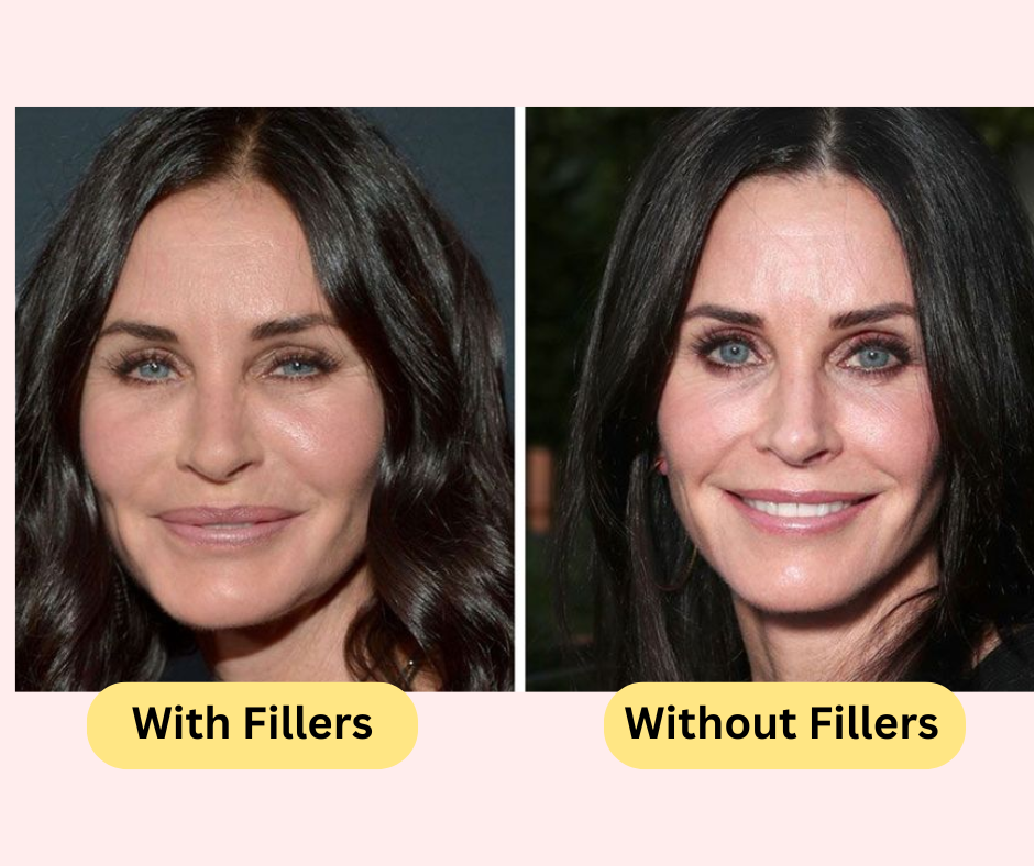 courtney-cox-with-and-without-fillers