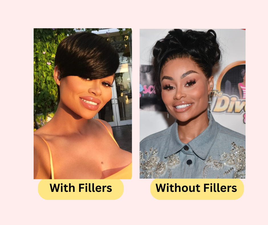blac-chyna-no-fillers