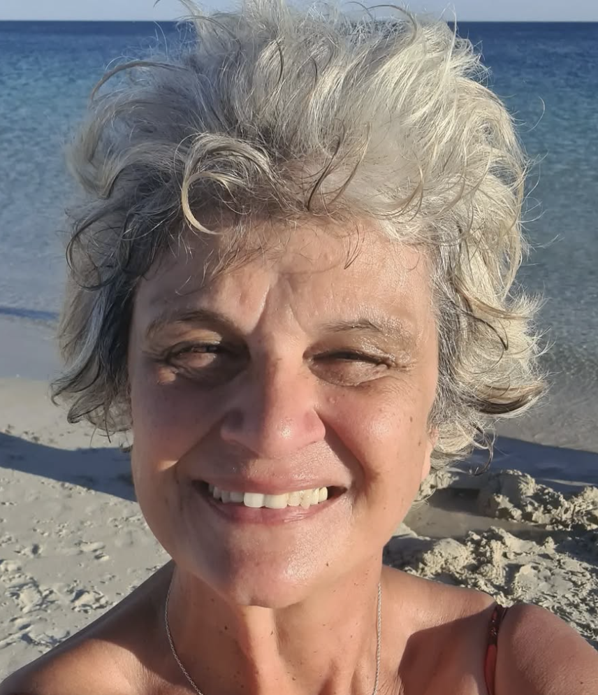 silver-fine-hair