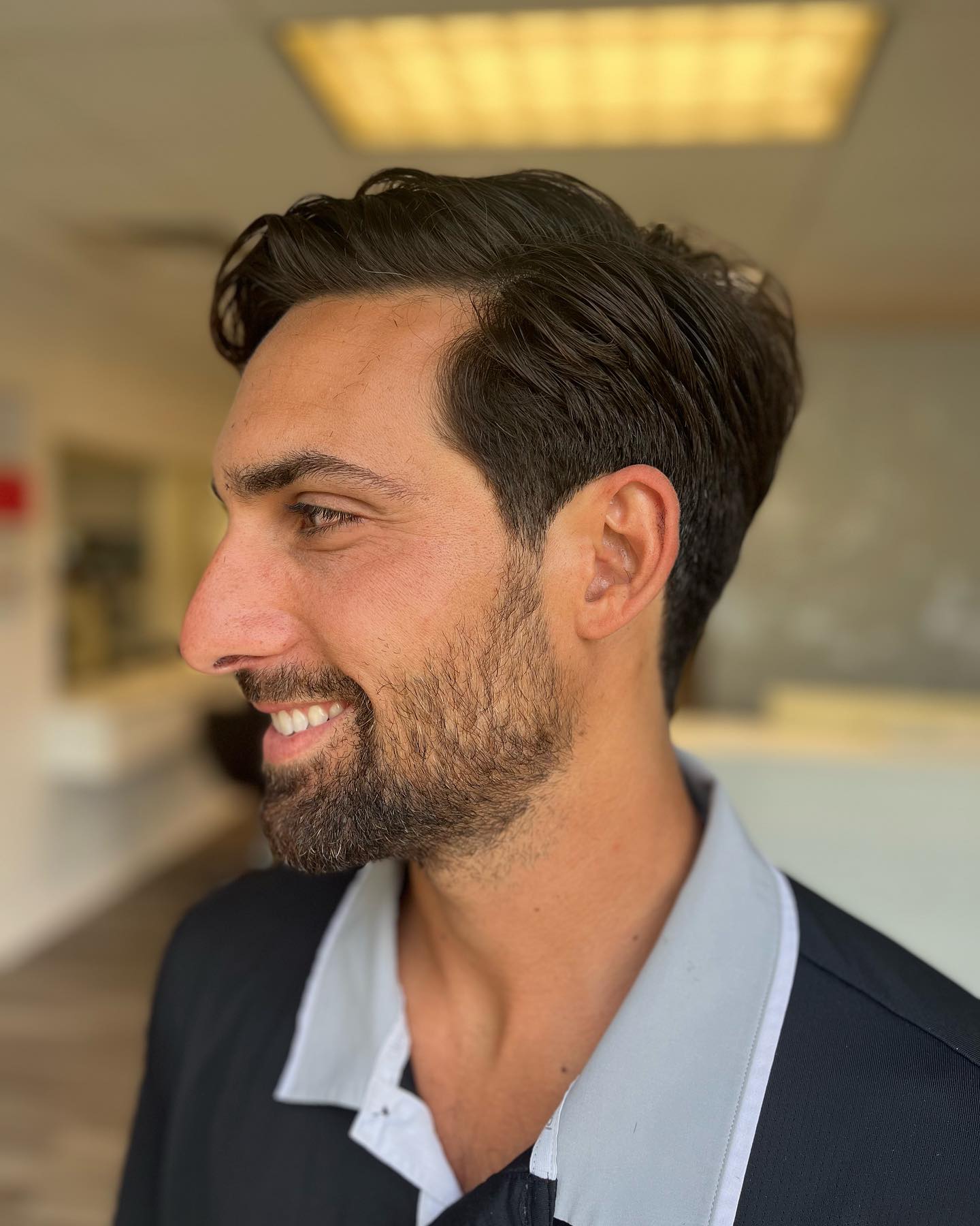 receding-hairline-haircut