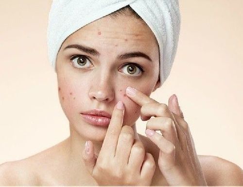 Acne-facial