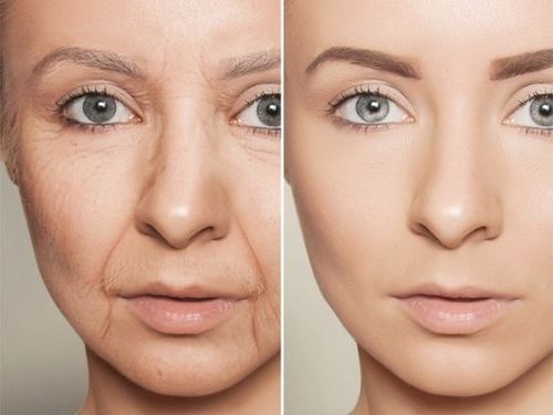 Anti-aging-facial