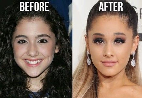 Ariana-Grande-eyebrow-lift