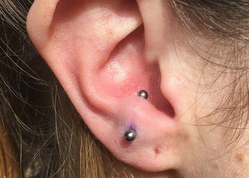 Anti-Tragus