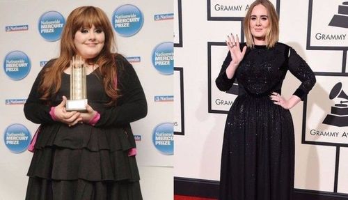 Adele weight loss and surgery