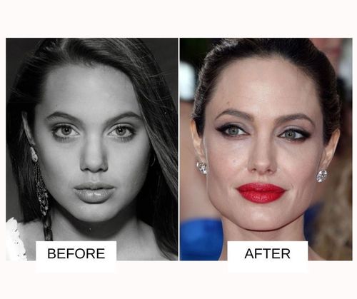 Anjelina Jolie lip job