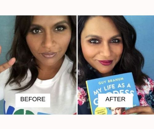 Mindy Kaling lip job