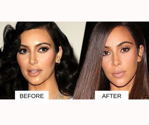 Kim Kardashian lip job