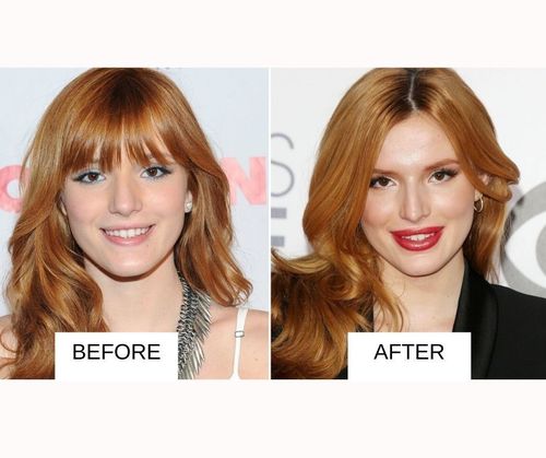 Bella Thorne lip job