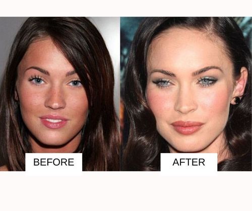 Megan Fox lip job