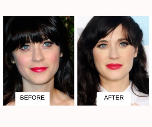 Zooey Deschanel lip job