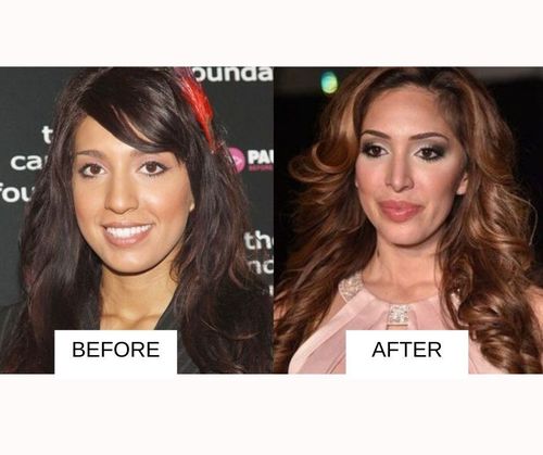 Farrah Abraham lip job