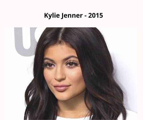 All The Plastic Surgery Procedures Kylie Jenner Has Undergone Full Details Fabbon 