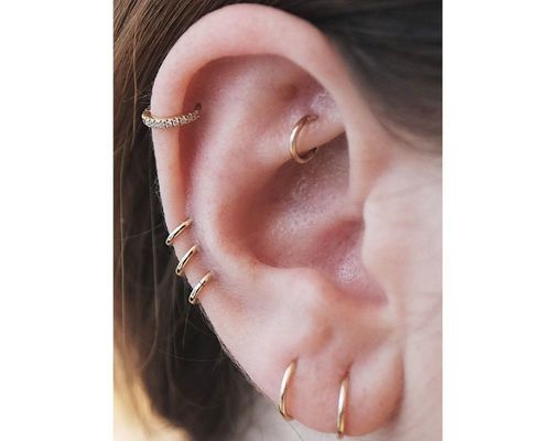10 Auricle