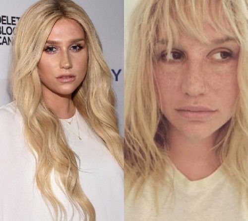 38 Kesha