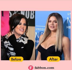 Khloe Kardashian Nose Job Regret