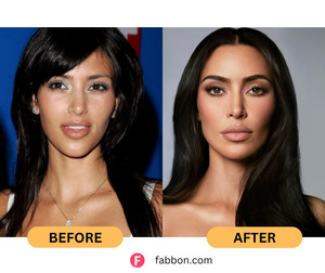 Kim Kardashian Plastic Surgery Secrets - Full Details
