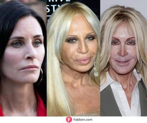 When Plastic Surgery Goes Wrong: Lessons from 21 Celebrity Disasters