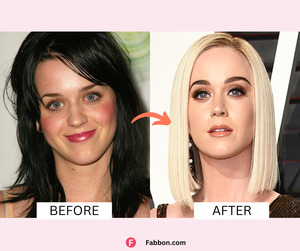 Celebrity Plastic Surgery: 51 Before And After Images 